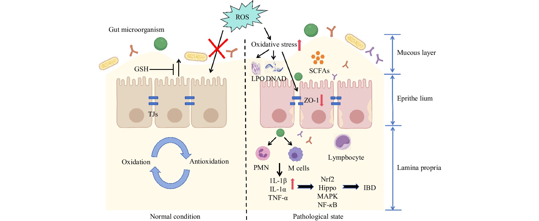 glutathione ibd The mechanism of improving by natural PSs. DSS: dextran sodium sulfate salt; CAT: catalase; ZO-1: occlusion zone-1; M1 cells: M1 macrophages; B cells: B lymphocytes Detangling